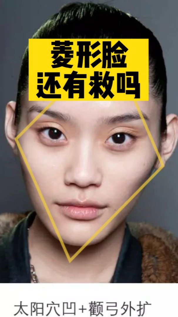 颧骨高怎么改善?