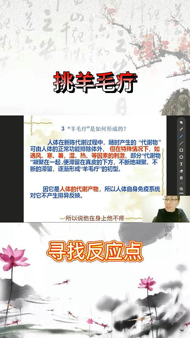 孙利群:羊毛疔如何形成,快速寻找反应点-度小视