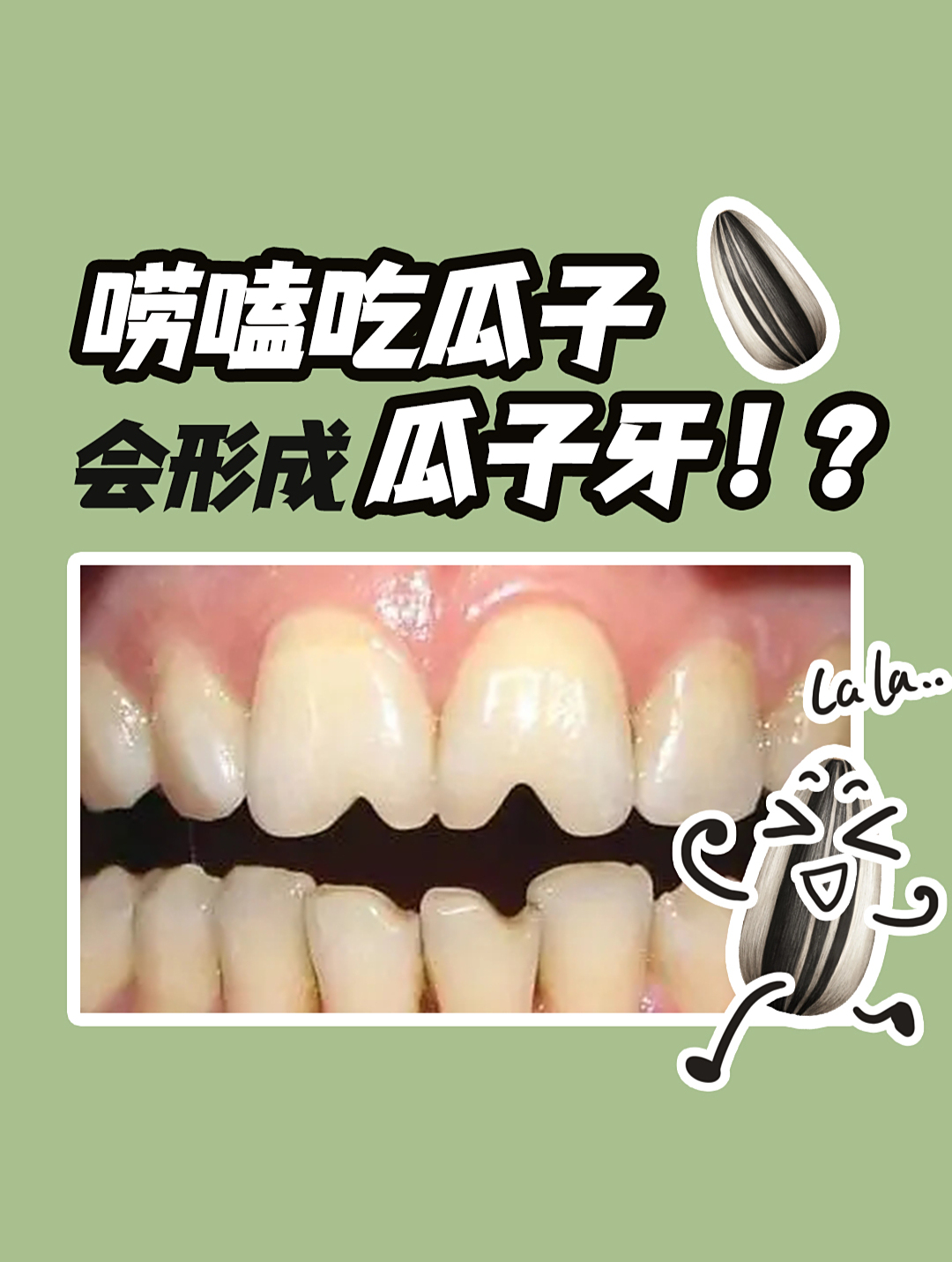 唠嗑吃瓜子能出现瓜子牙瓜子牙又是什么