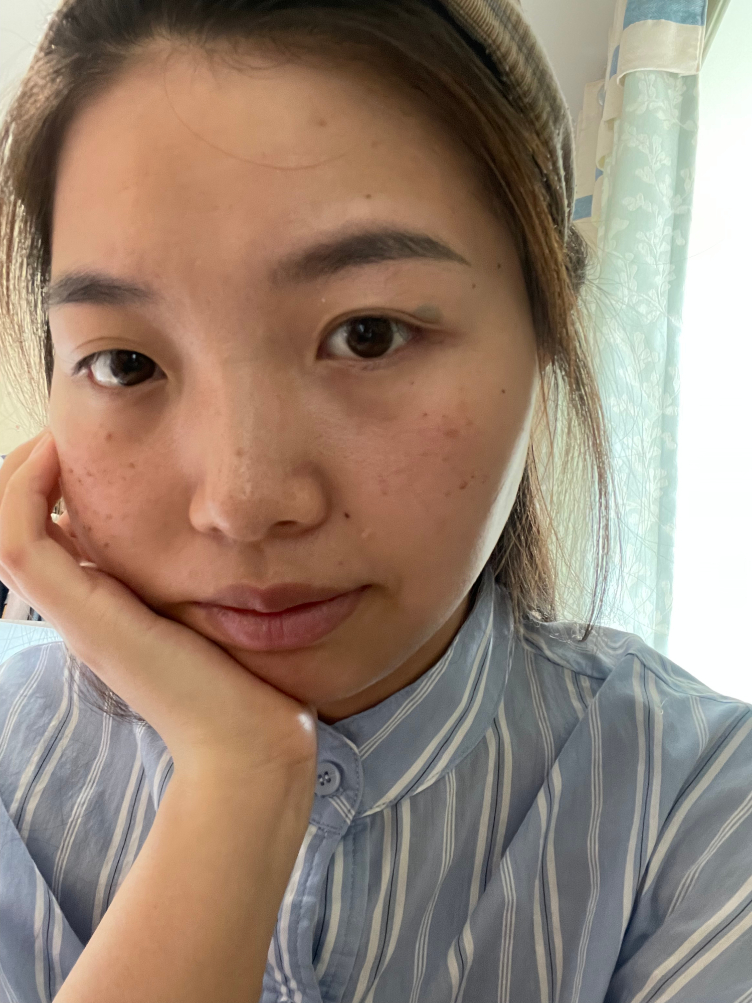 淡斑祛斑,选它,其实也简单