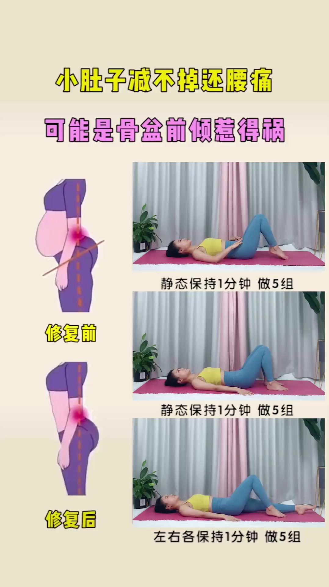 三招教你消除骨盆前倾,躺着拥有好身材
