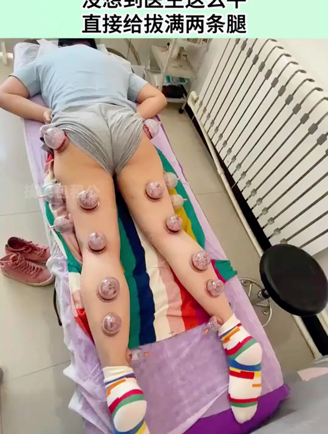 患风湿病的美女去拔罐,没想到医生这么牛,直接给拔满两条腿!-度小视