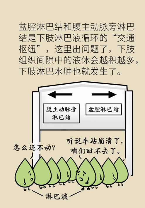 之所以会出现这种情况,一般是因为肿瘤患者体内的淋巴液回流受阻,导致