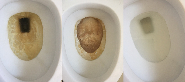 马桶尿碱黄垢怎么去除?