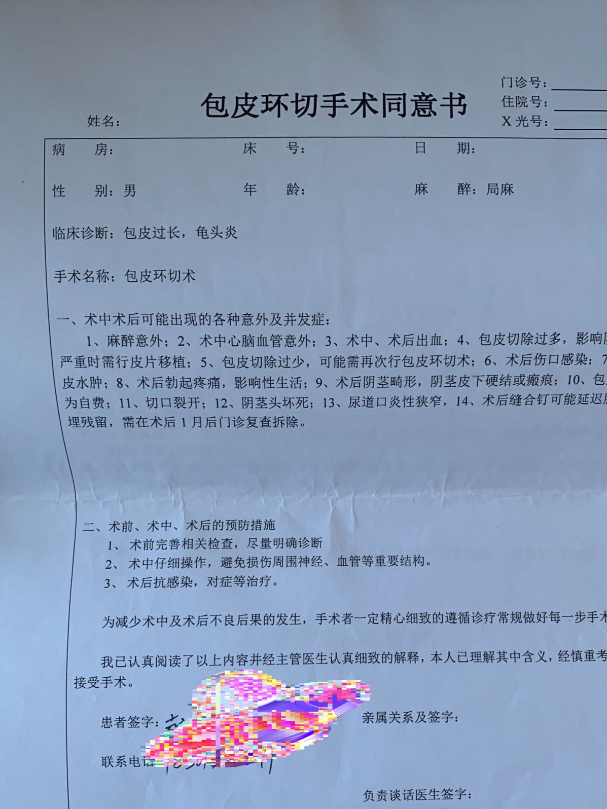 记录一次性吻合器割包皮的个人经历