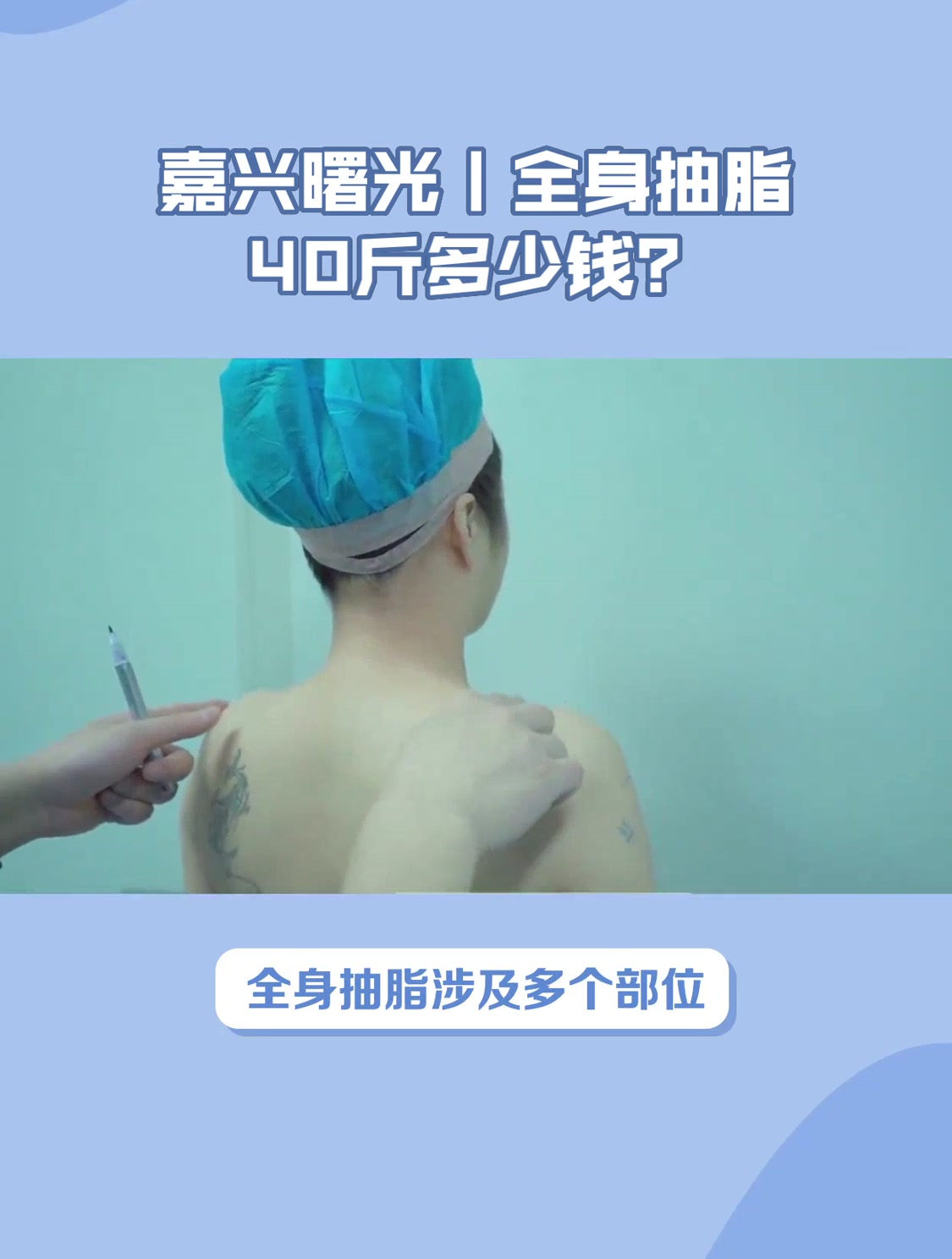 嘉兴曙光丨全身抽脂40斤多少钱?