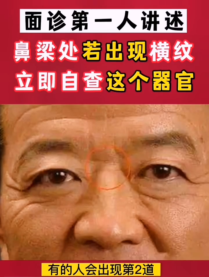 面诊第一人王鸿谟:鼻梁处若出现横纹,请立即自查这个部位!-度小视