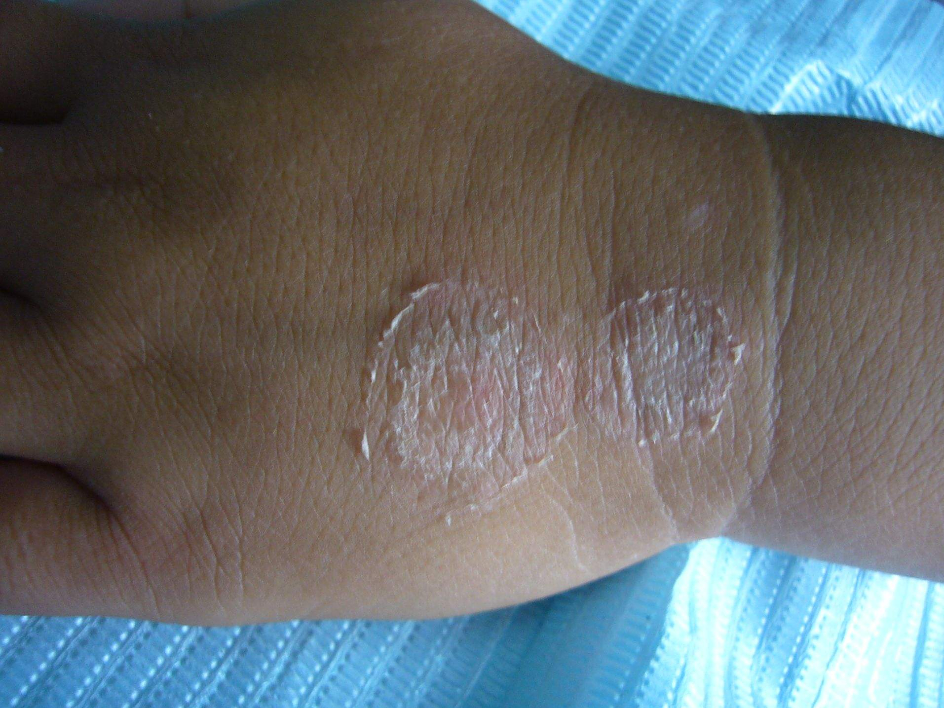 高危行为后,别把艾滋病当皮肤病,若出现3种情况,或身体在求救