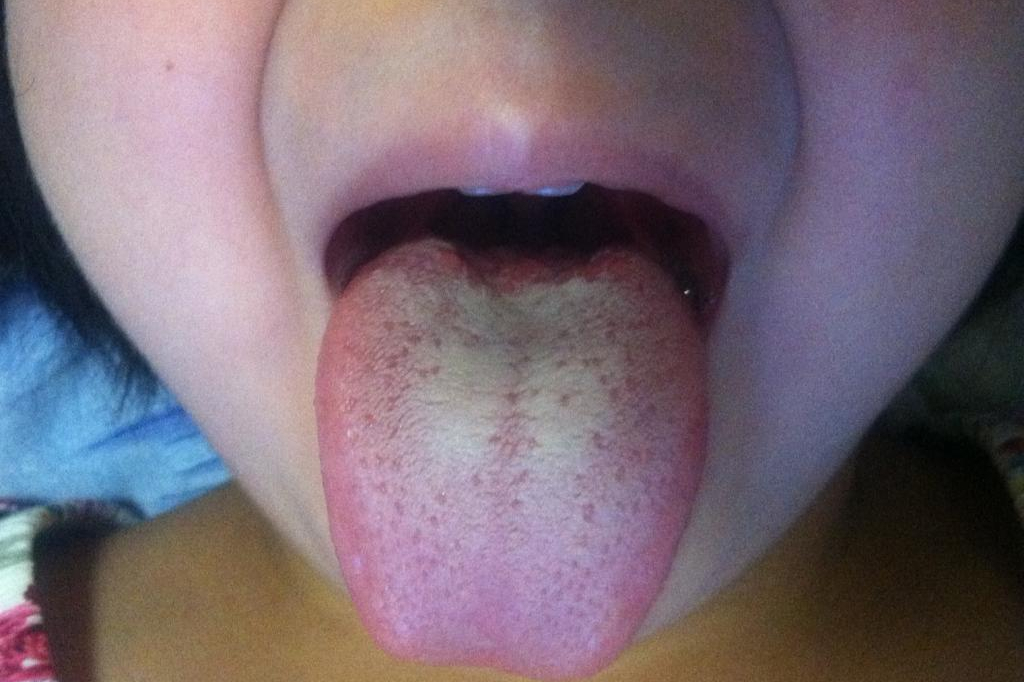 中医:舌为心之苗,心脏不好舌头或会出现4个变化,不妨自查一下