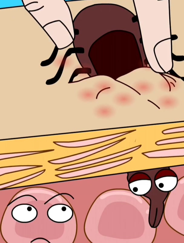 这小蜱虫太讨厌了