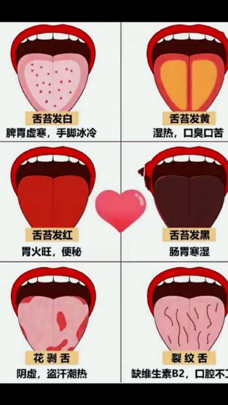 看看你的舌头是什么样子,对应什么问题