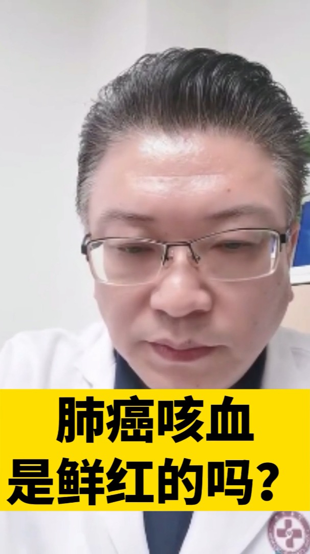 肺癌咳血是鮮紅的?醫生警示:得看情況!建議收藏