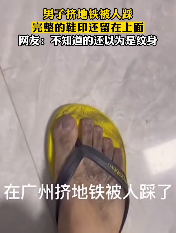 男子挤地铁被人踩,完整的鞋印还留在上面