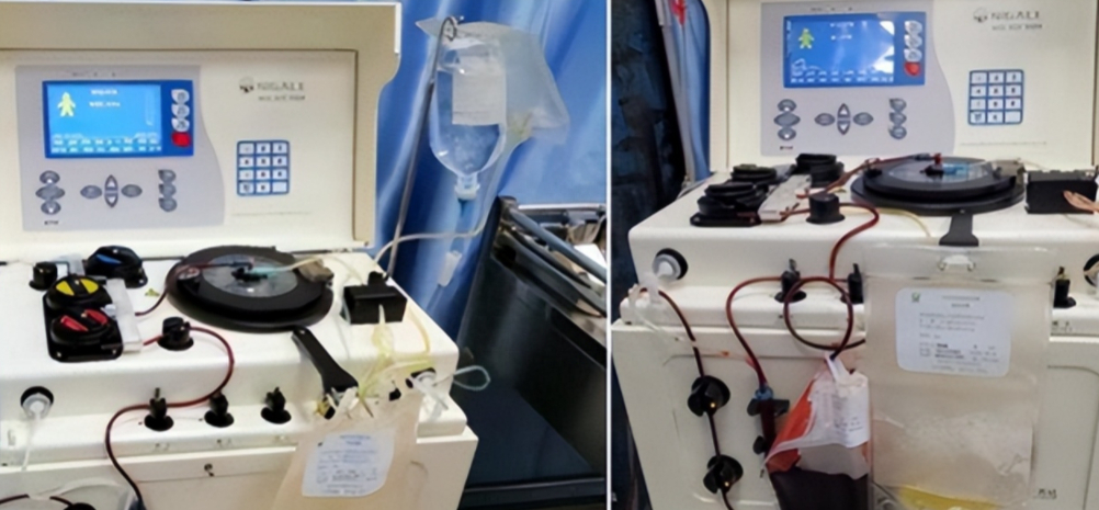 回顾11 年:云南女学生捐骨髓救人,患者康复后却这样说