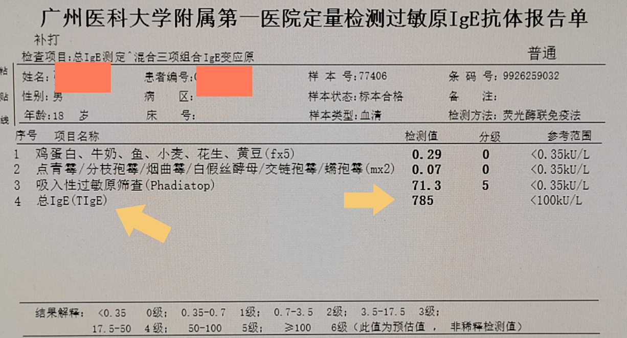 过敏检查的报告怎么看?