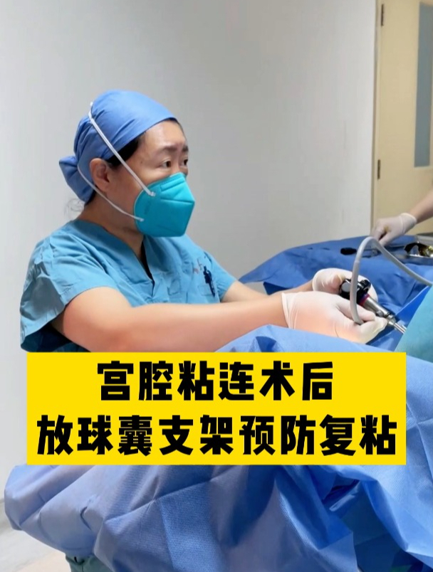 宫腔粘连术后最好防止复粘的方法