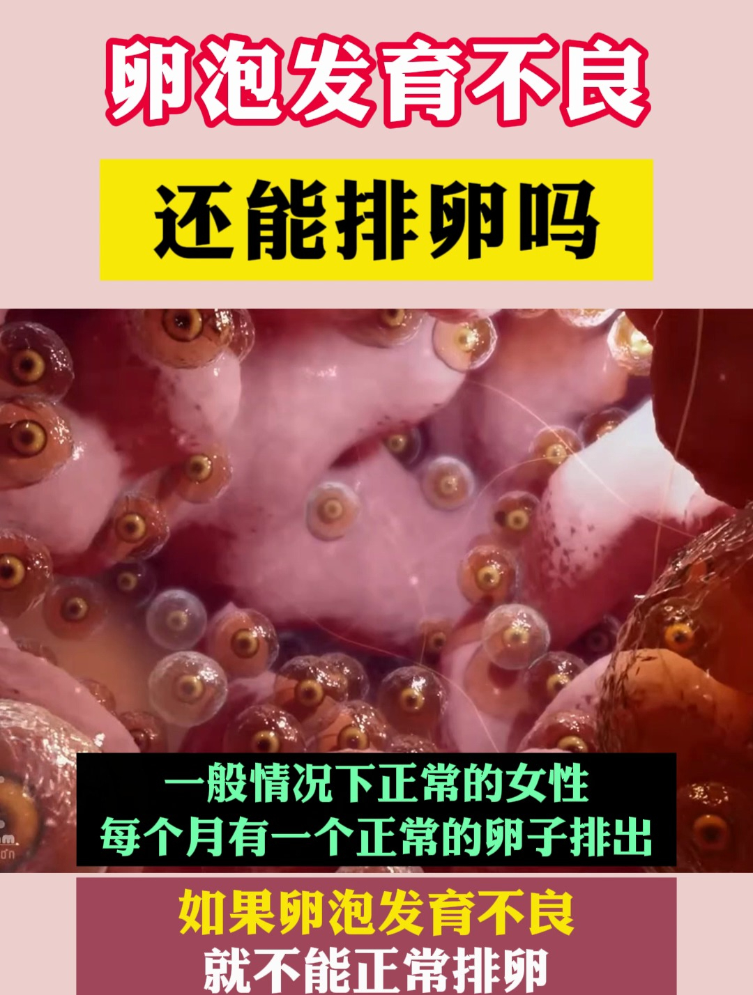 卵泡发育不良,还能排卵吗?-度小视