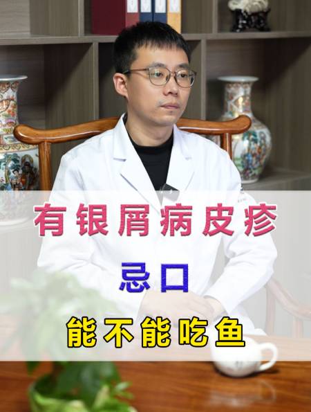 有银屑病皮疹忌口能不能吃鱼-度小视