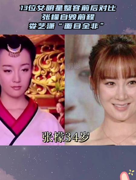 13位女明星整容前后对比张檬自毁前程娄艺潇面目全非