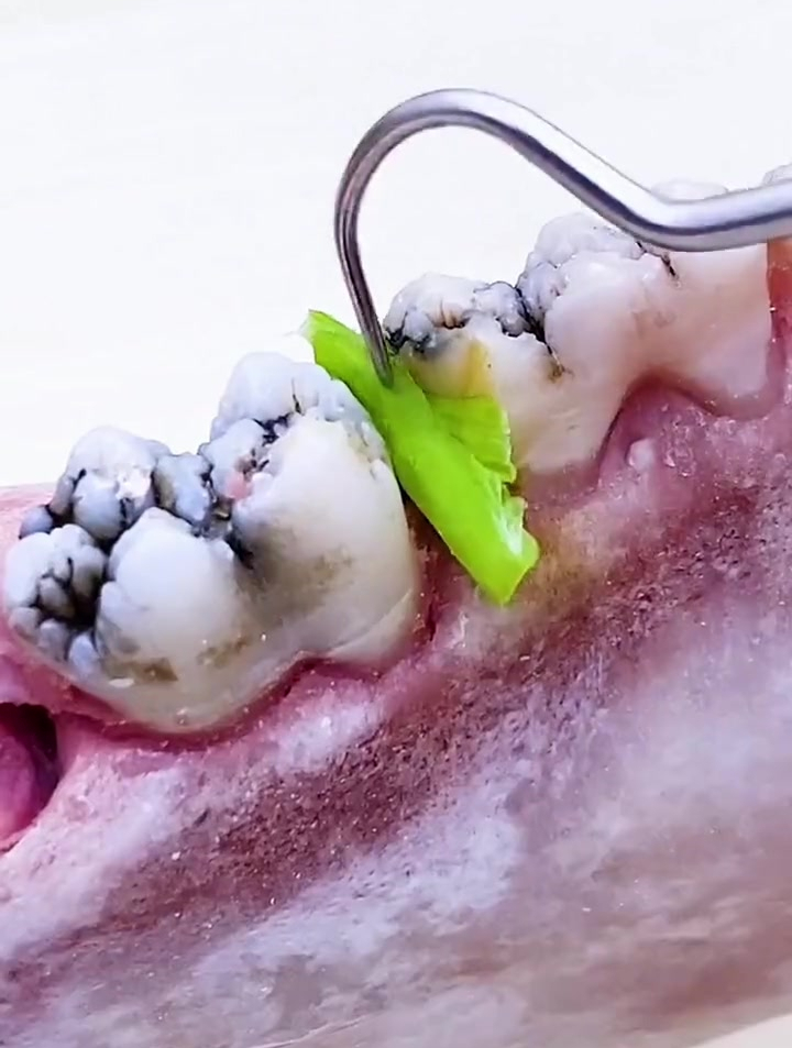 吃饭经常塞牙的,用这个牙签套装