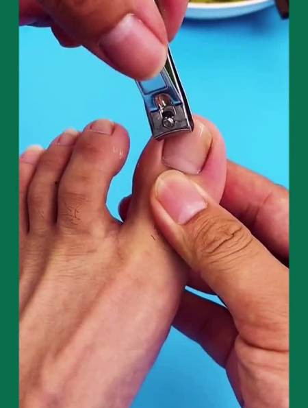 鹰嘴指甲钳鹰嘴钳指甲刀脚指甲往肉里长怎么办-度小视