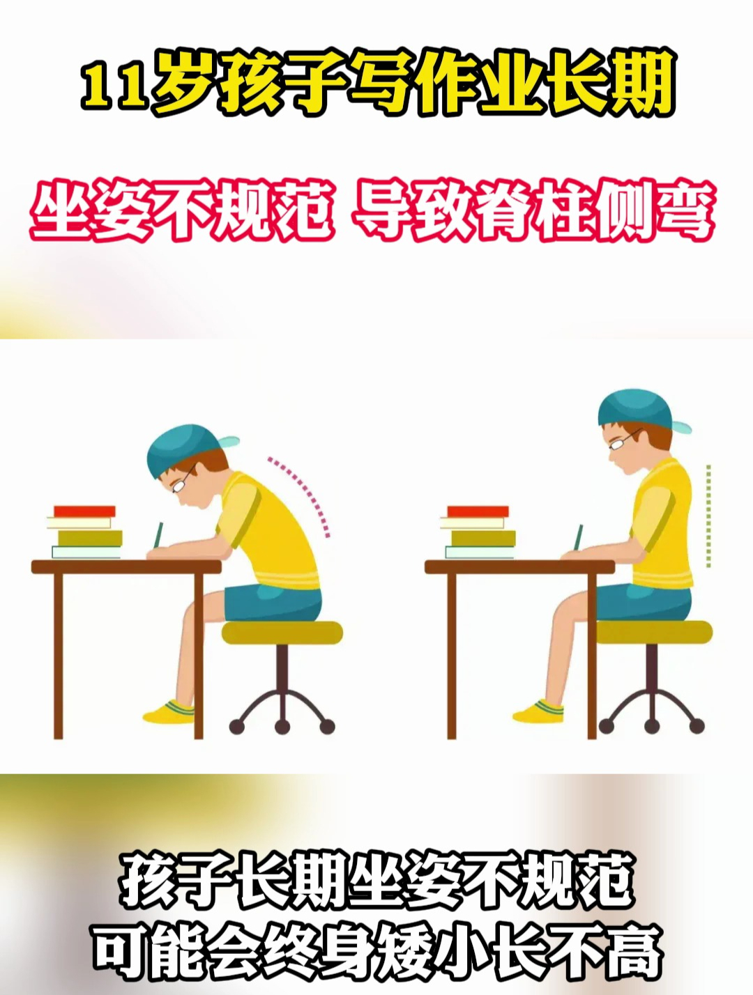 11岁孩子写作业长期坐姿不规范,导致脊柱侧弯