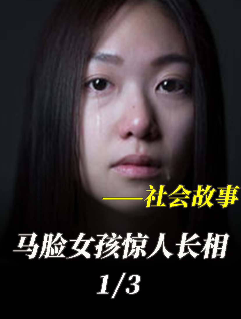 22岁马脸女孩蒙脸生活13年背后真相令人心酸
