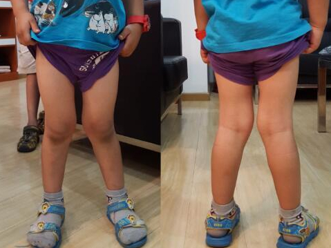 五岁小孩正常腿型图片