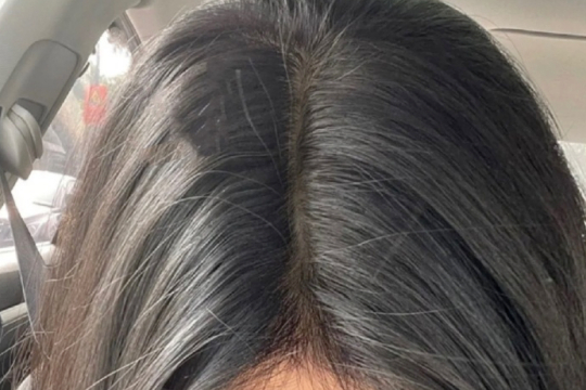 发缝变回"小地缝"!