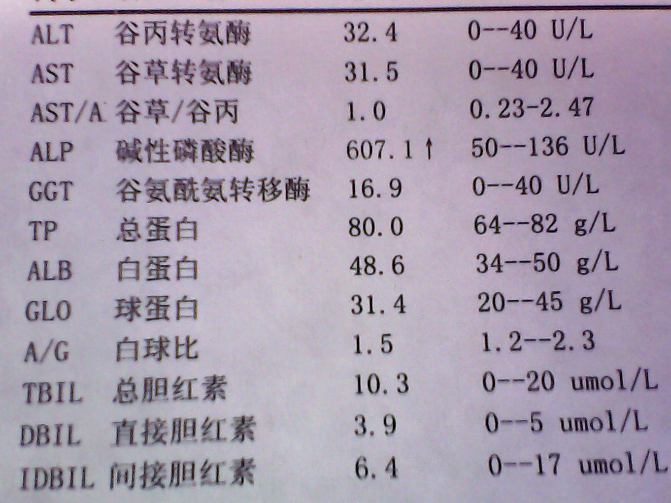 儿童碱性磷酸酶300多图片