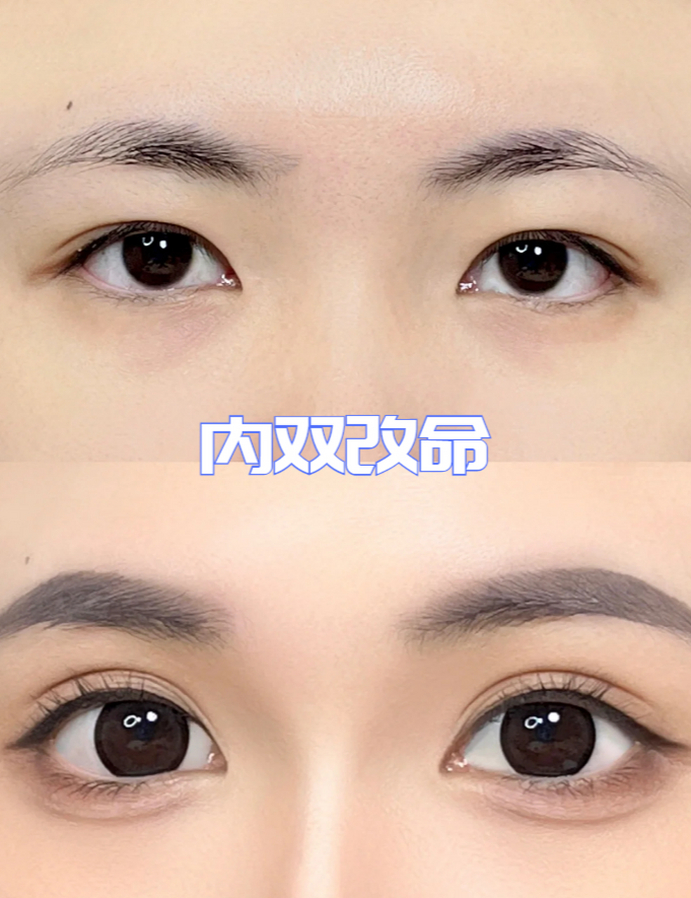 对于内双的人来说,改变命运的关键在于将眼睛变成外双,同时注重眼睛下