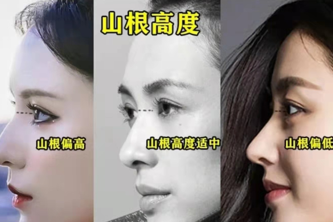 通常好看的鼻子,山根都不会太低,当然也有例外
