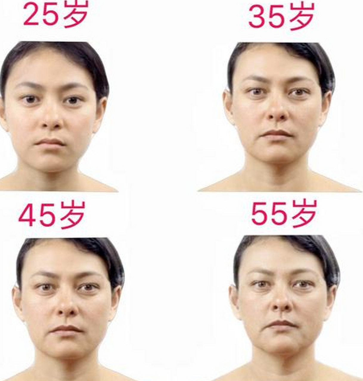 中老女性面部衰老,到底是从哪个部位引起的?