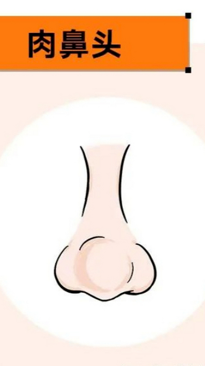 很多人分不清自己是蒜头鼻还是肉鼻头,那么肉鼻头和蒜头鼻有什么区别
