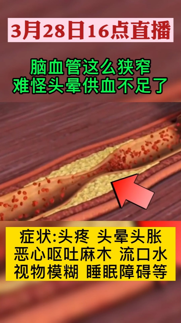 脑血管狭窄供血不足头晕头痛