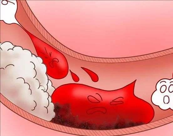 久坐不动容易血瘀,医生建议:掌握4个好方法,或助行气活血