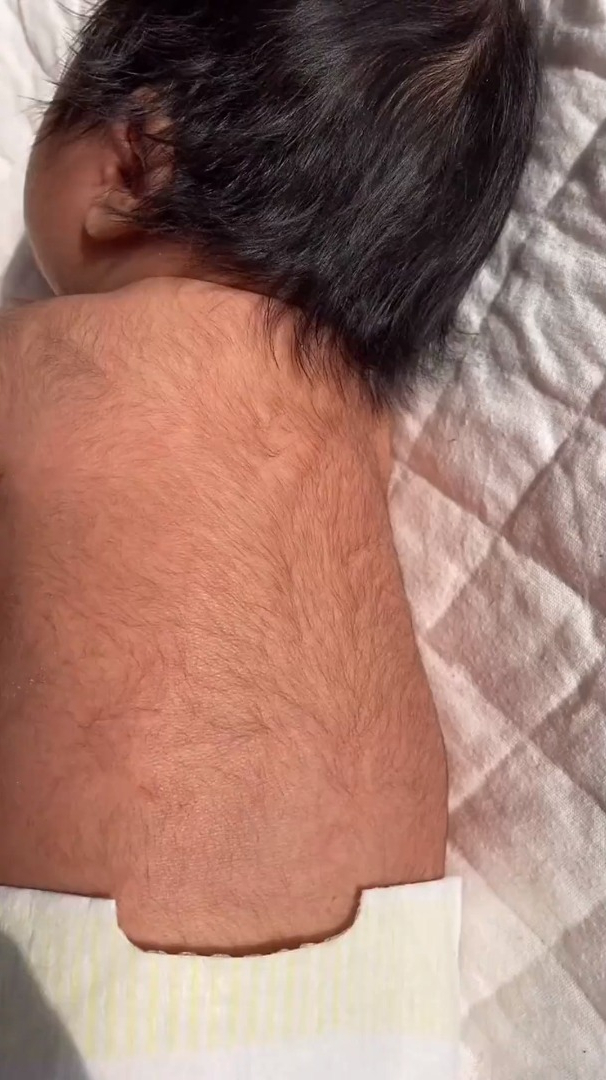 出生十天的宝宝,这一身的胎毛,关键是俺们是个女宝宝!