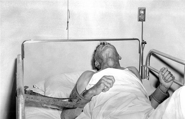 男子狂犬病发作离世,死前已注射疫苗,为什么人还是没了?