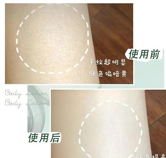 头皮癣可以擦身体乳吗女生（头皮癣可以擦身体乳吗女生可以用吗）
