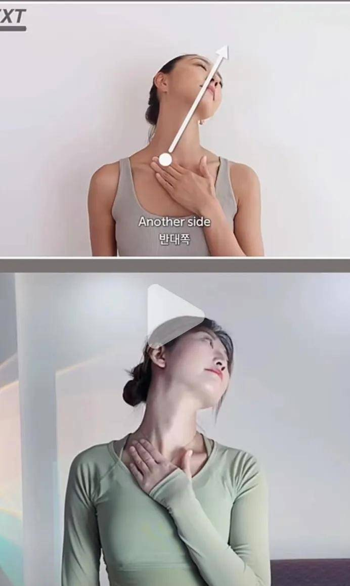 step②歪头杀下颌缘拉伸我们先找到颈阔肌的位置,两个嘴角同时向两边