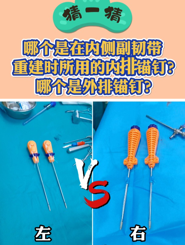 猜一猜哪个是内侧副韧带重建的内排锚钉?