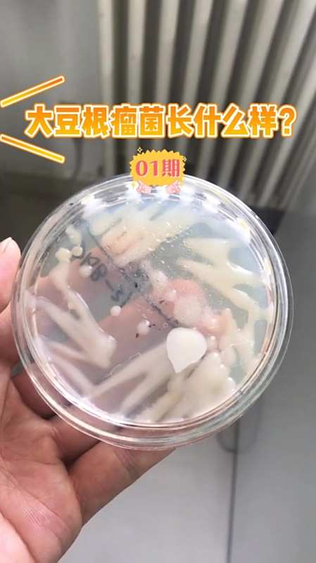 大豆根瘤菌长什么样一起来认识认识吧