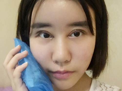 做眼综合手术的适应人群,禁忌人群有哪些?应注意什么事项