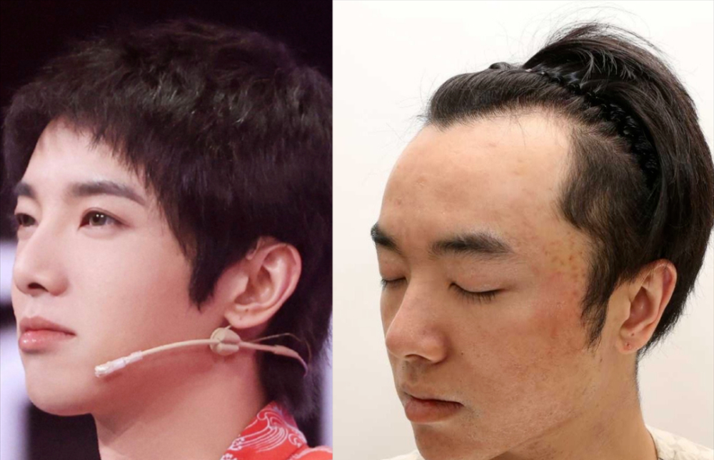 华晨宇被曝整容植发,知情人晒出大量视频和照片,对比之下太明显