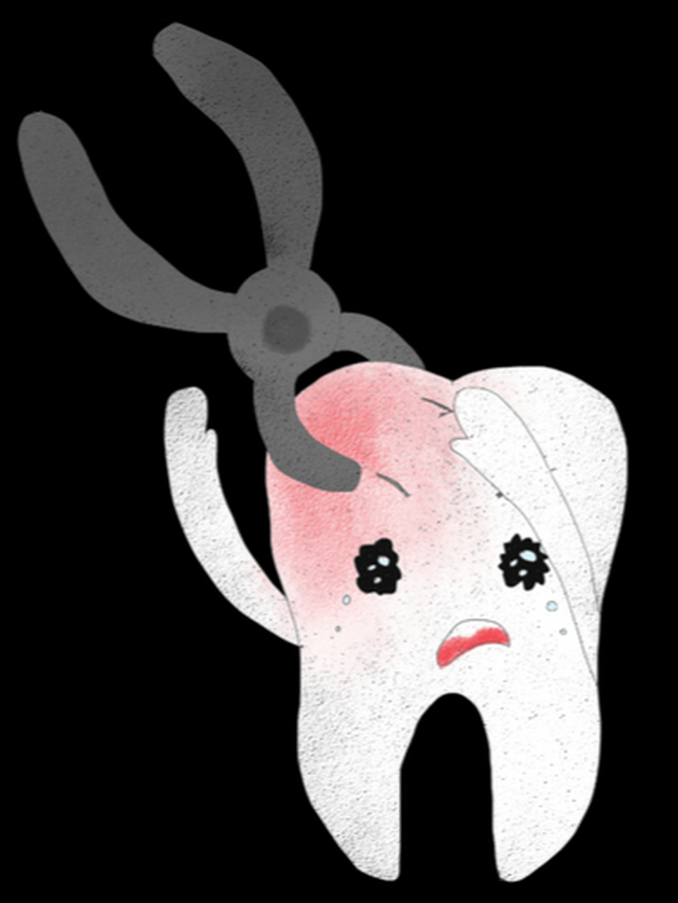 一是智齿冠周炎,二是造成相邻牙的损害.