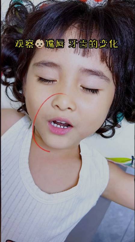宝宝长期张嘴睡觉是真的会变丑,嘴巴凹进去就不好看了,还好有它-度小