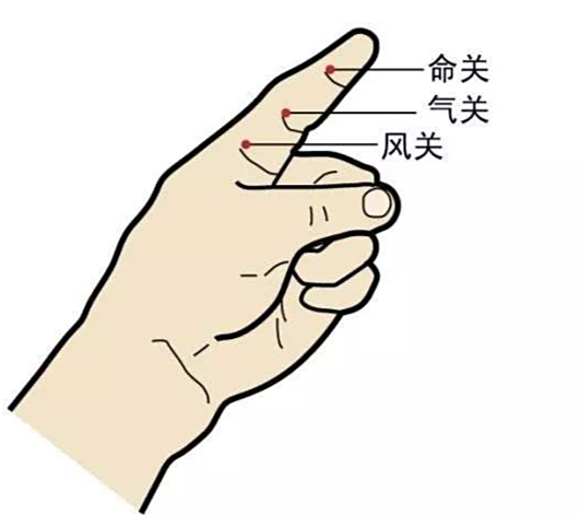 灸命关穴保固不死