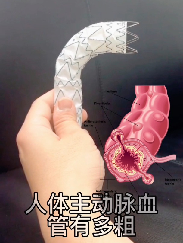 人体主动脉血管有多粗?