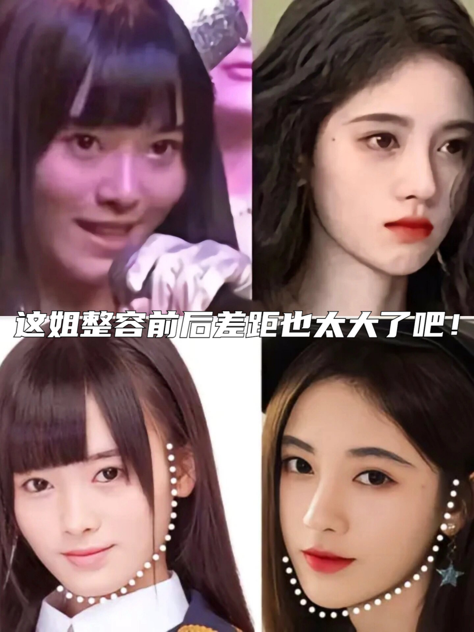 鞠婧祎整容前后对比!大变样! 整容后的鞠婧祎美得让人惊艳!