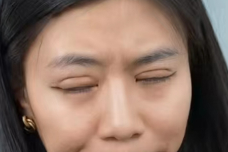 张雨绮的扇形双眼皮宛若新生,怎样做出又好看又自然的双眼皮?